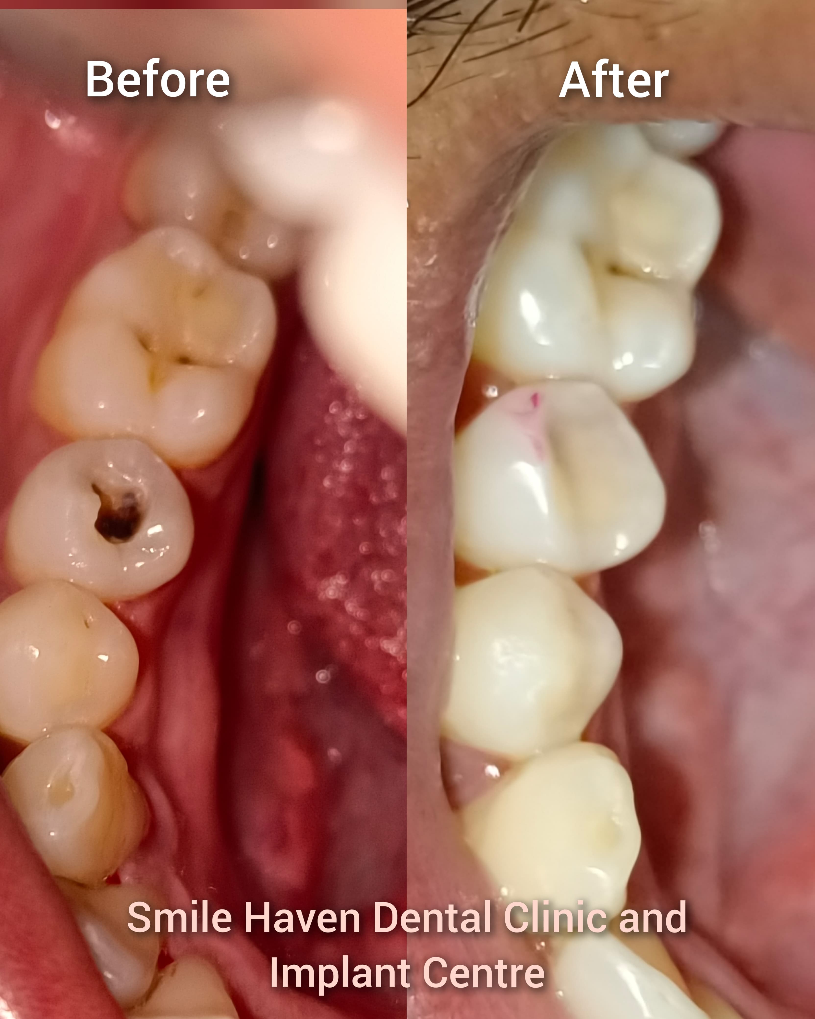 Before & After 1