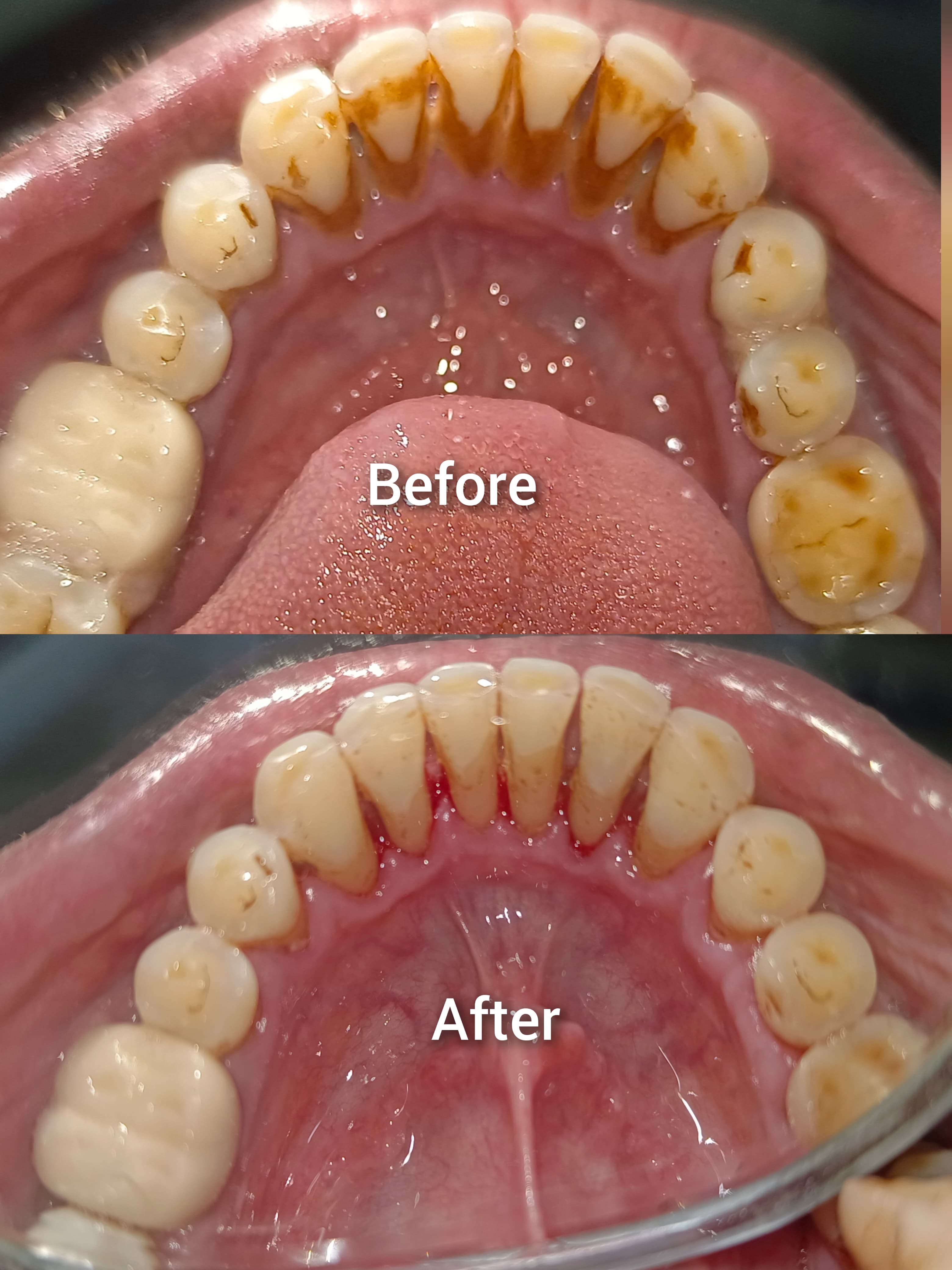 Before & After 2