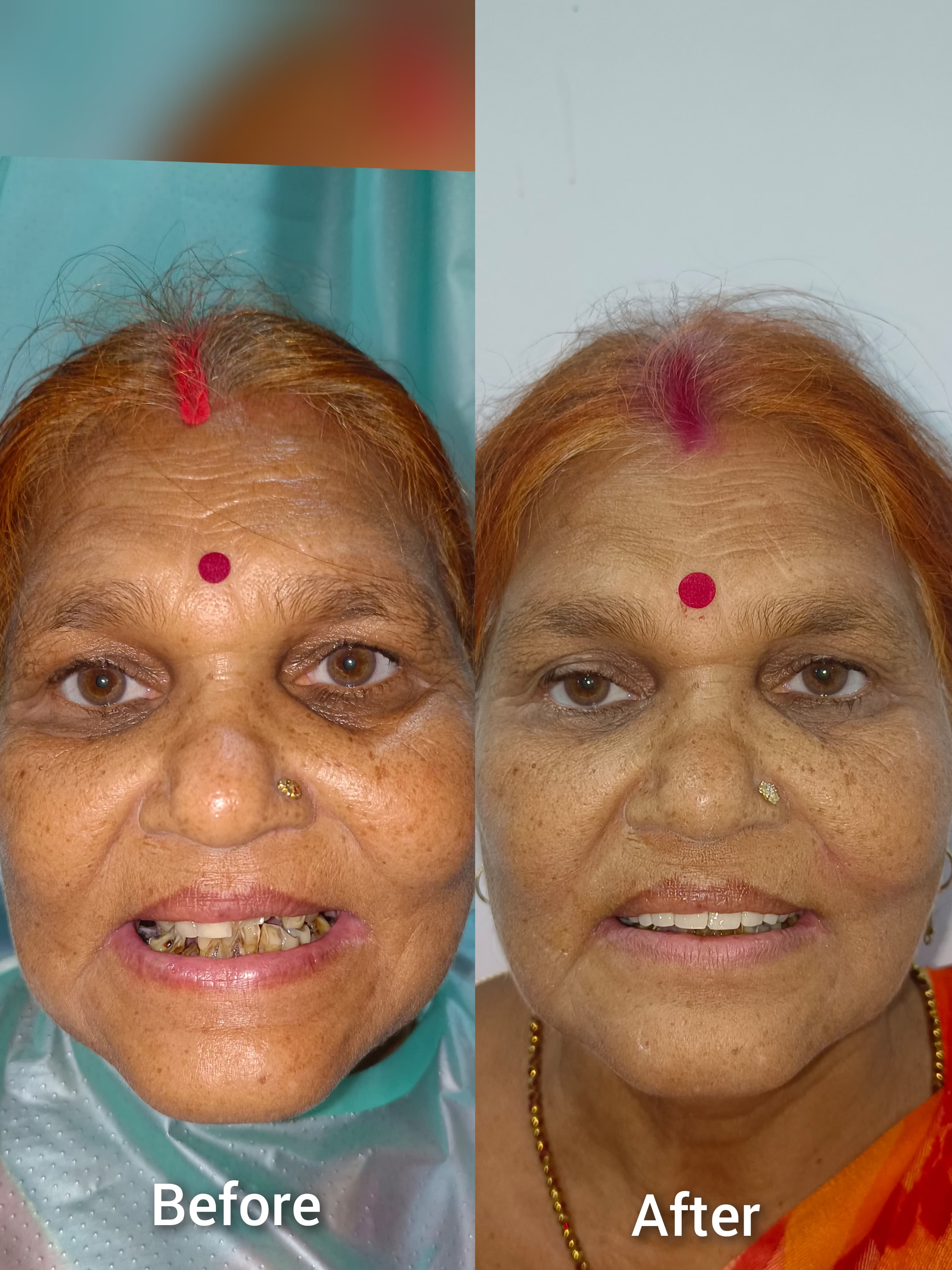 Before & After 3