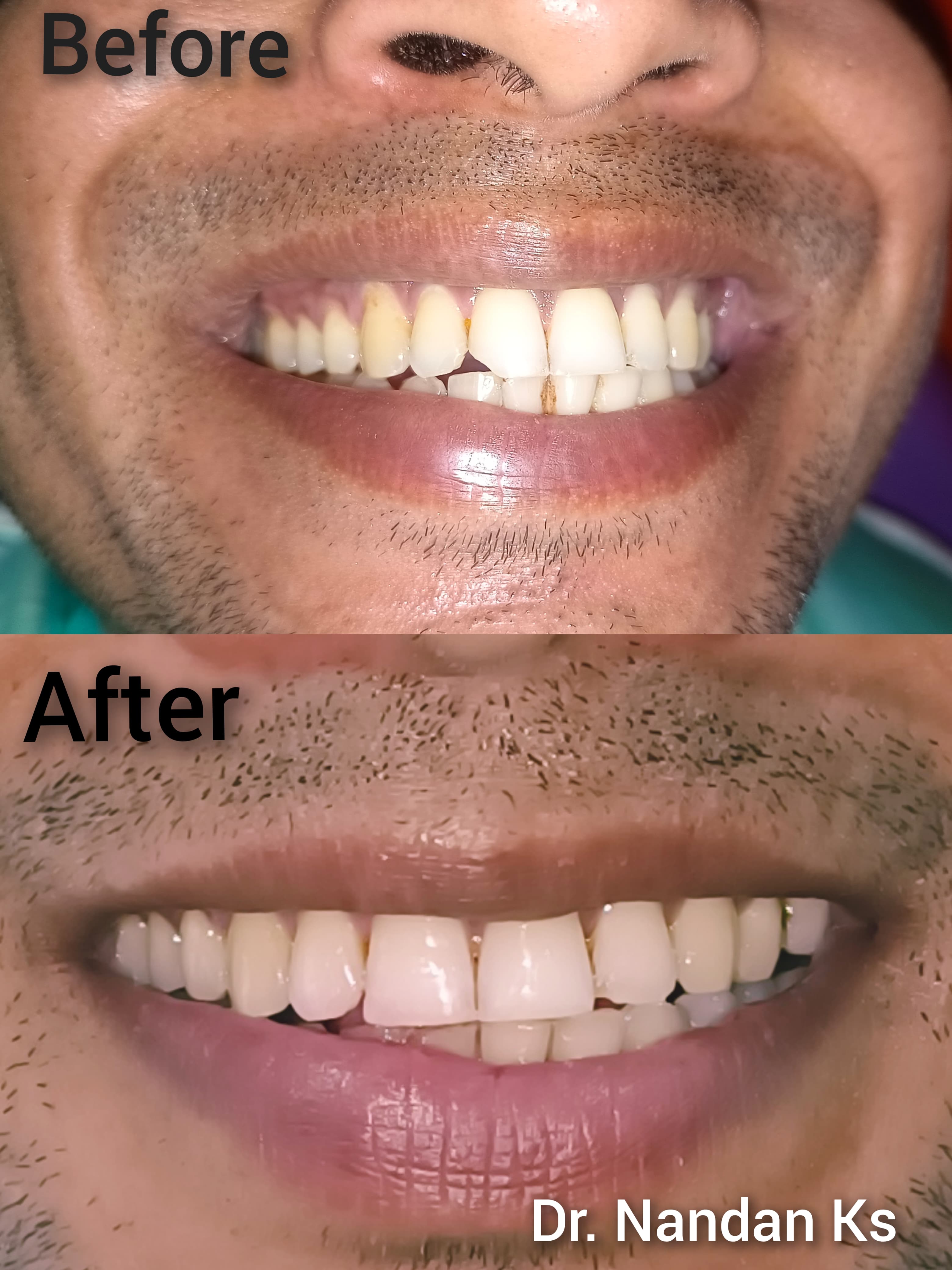 Before & After 5